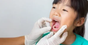 Karies pada anak anak