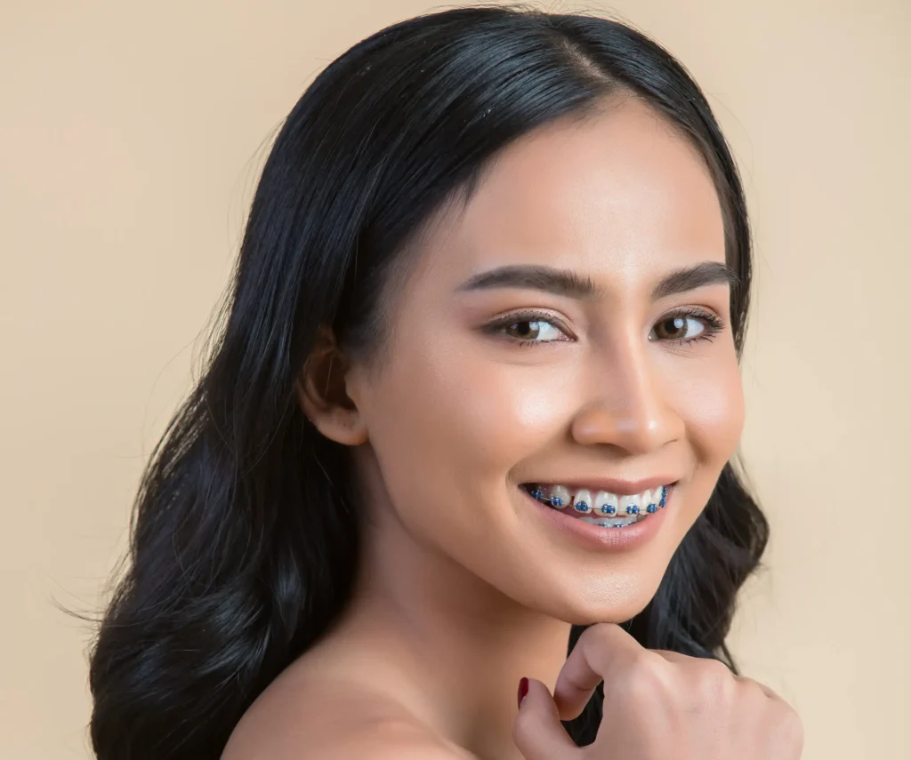 Tampilan Ortho / Behel