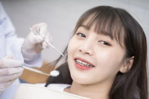 Kenali biaya pasang behel gigi Pasuruan, jenis-jenis behel seperti metal, self ligating, dan aligner KLAR, plus tips perawatan untuk senyum yang lebih rapi.