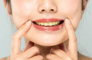 Gigi tampak kusam? Pelajari penyebab gigi kuning dan cara agar gigi tidak kuning, termasuk perawatan medis untuk memutihkan gigi kuning dengan aman di klinik.