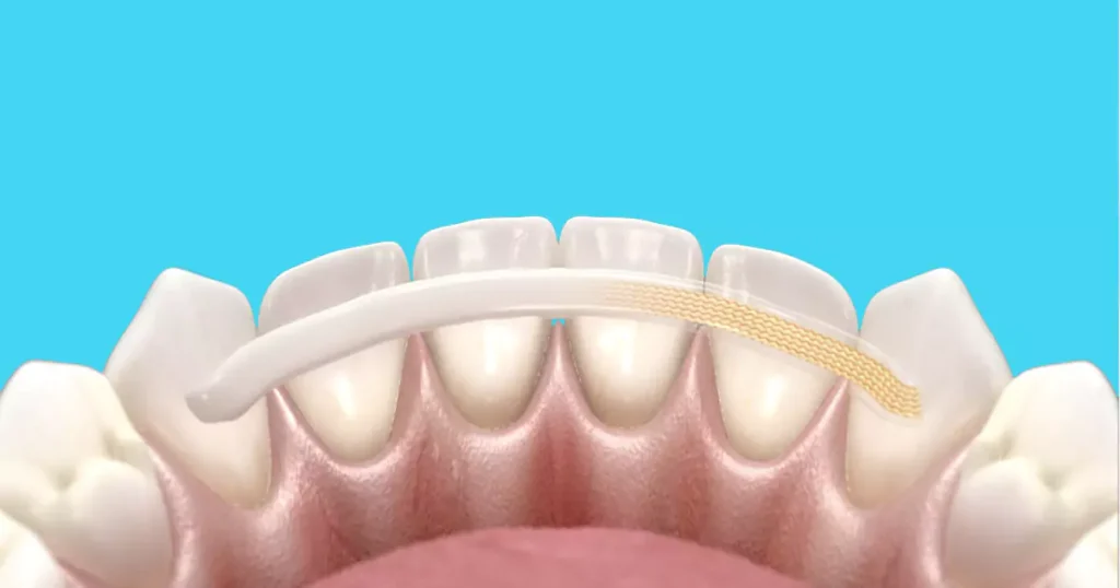 Dalam kedokteran gigi, tingkat kegoyangan dinilai berdasarkan derajat tertentu untuk menentukan cara mengatasi gigi goyang yang paling tepat serta prognosisnya