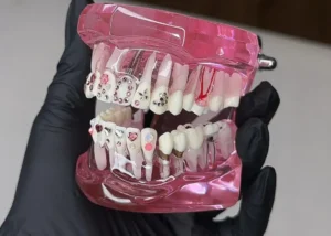 Ingin senyum lebih berkilau dengan diamond gigi? Kenali prosedur pemasangan tooth gems yang aman, harga, dan daya tahannya. Jangan pasang sembarangan di salon