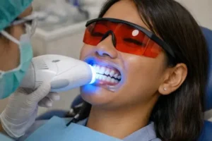 Bolehkah bleaching gigi saat puasa Ramadan? Simak penjelasan dokter tentang bleaching puasa, scaling Ramadan, serta waktu terbaik perawatan gigi sebelum Lebaran