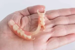 Kenali gigi palsu Valplast, kelebihan dan keterbatasannya dibandingkan akrilik, cara merawatnya, serta hal yang perlu dipertimbangkan sebelum memilih