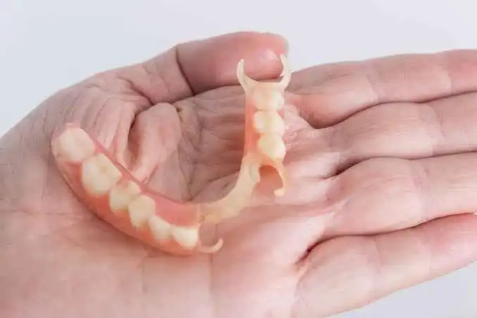 Kenali gigi palsu Valplast, kelebihan dan keterbatasannya dibandingkan akrilik, cara merawatnya, serta hal yang perlu dipertimbangkan sebelum memilih